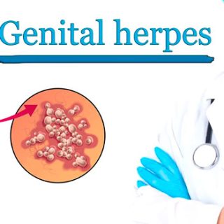 genital-herpes-symptom